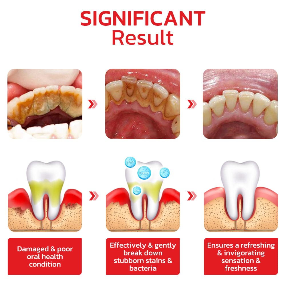 SP-4 Probiotic Intensive Teeth 🦷 Whitening Toothpaste 😁  ⭐️⭐️⭐️⭐️ 4.9/5 Reviews