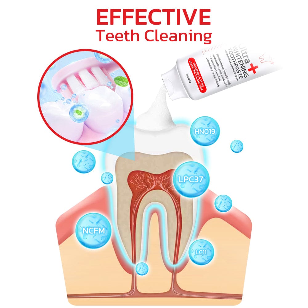 SP-4 Probiotic Intensive Teeth 🦷 Whitening Toothpaste 😁  ⭐️⭐️⭐️⭐️ 4.9/5 Reviews