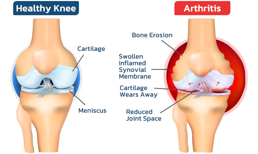 BeeTherapy™ Joint and Bone Therapy Cream - (Buy 1 get 2 Free🔥)