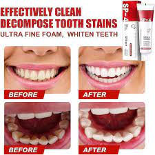 SP-4 Probiotic Intensive Teeth 🦷 Whitening Toothpaste 😁  ⭐️⭐️⭐️⭐️ 4.9/5 Reviews